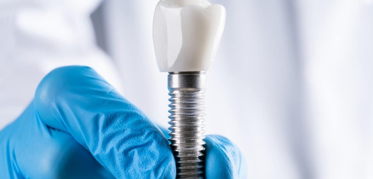 the longevity of your dental implant